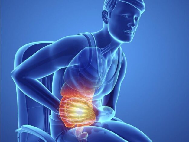 decodage-calculs-biliaires